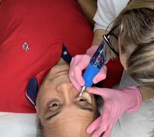 dark eye bag treatment in progress dark eye bag treatment in progress