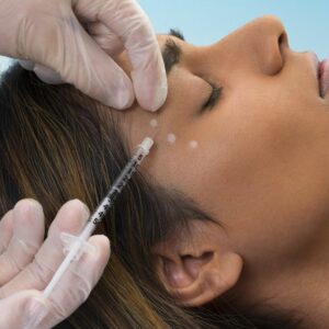 anti-wrinkle injection photo