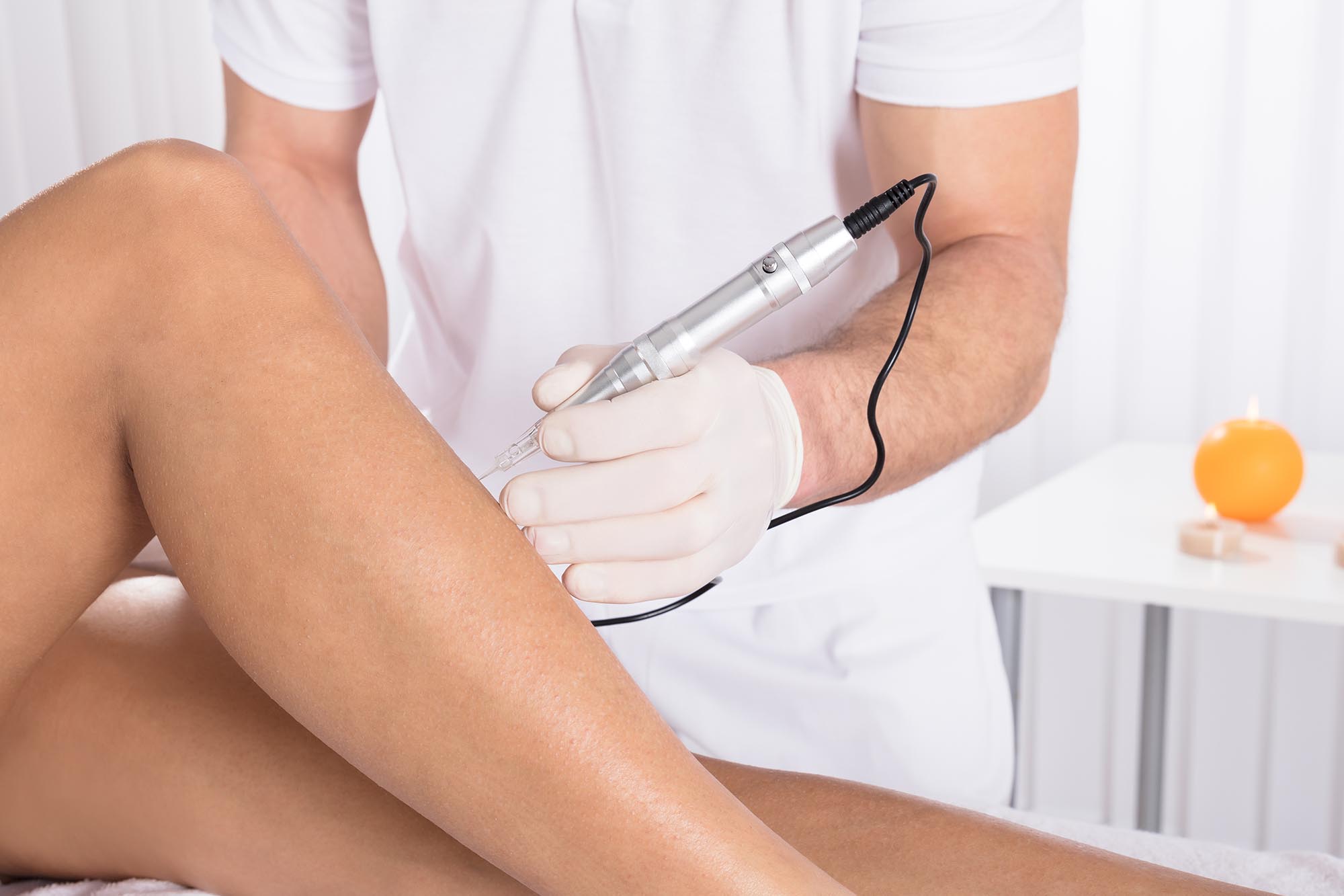 mca-needling mca dry skin needling